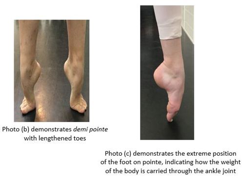 Feet in demi pointe and one on pointe